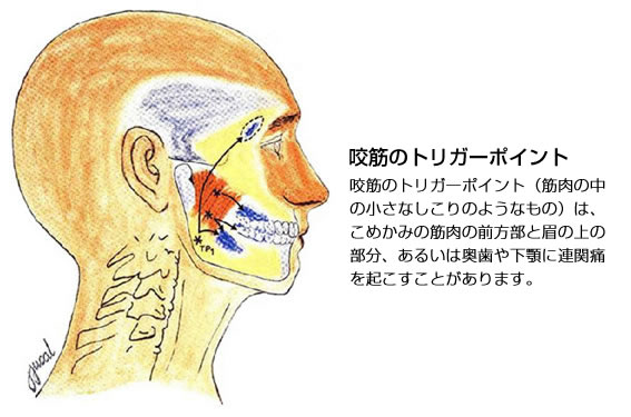 連関痛 れんかんつう とは 福岡顎関節症治療研究所 スマートフォン